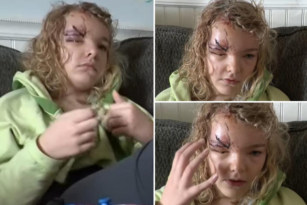 dog-attacks-long-island-girl